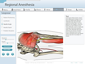 virtual nerve block screen shot